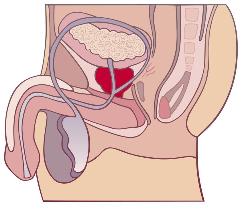 Todo sobre a prostatite