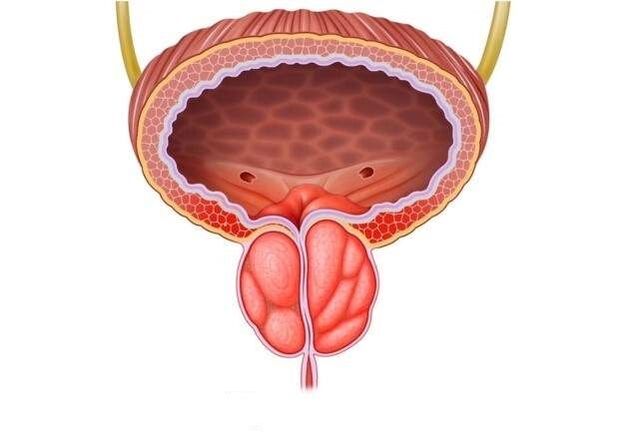 Inflamación da próstata nos homes