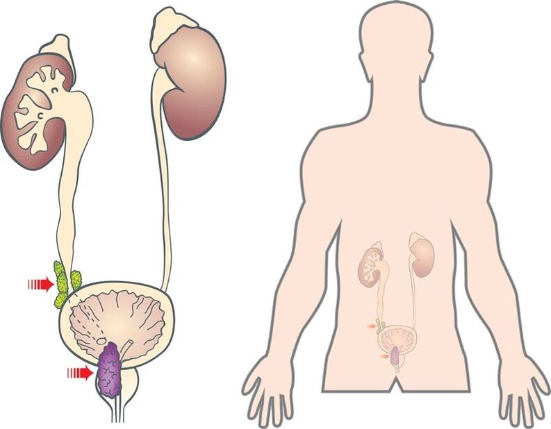 Síntomas e causas do adenoma de próstata